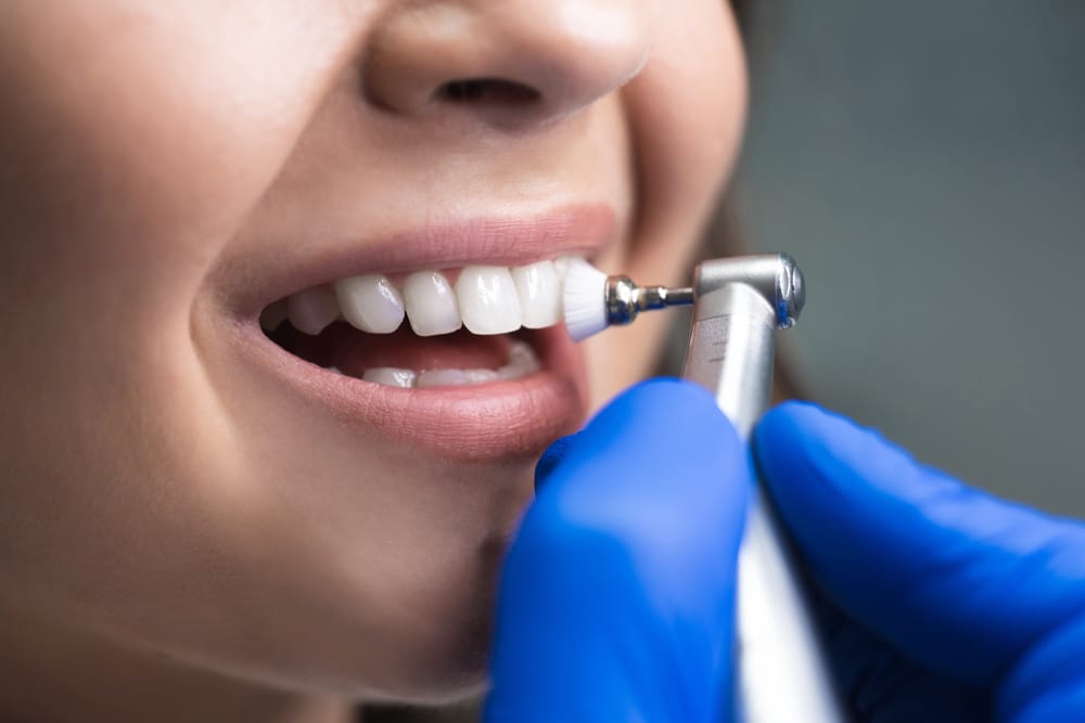 Dental Cleaning in Westlake Village: Refresh Your Smile with Professional Care
