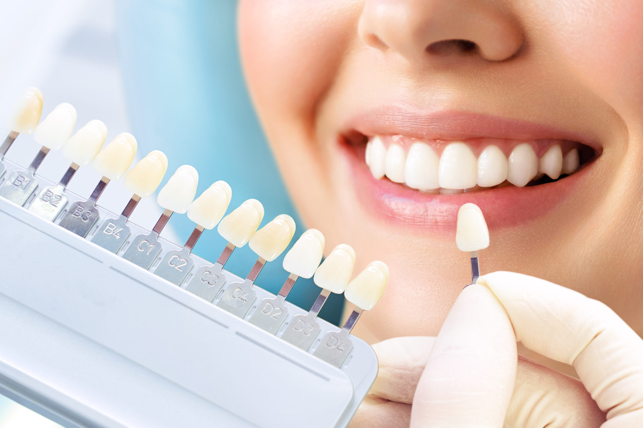 Porcelain Veneers in Westlake Village, CA