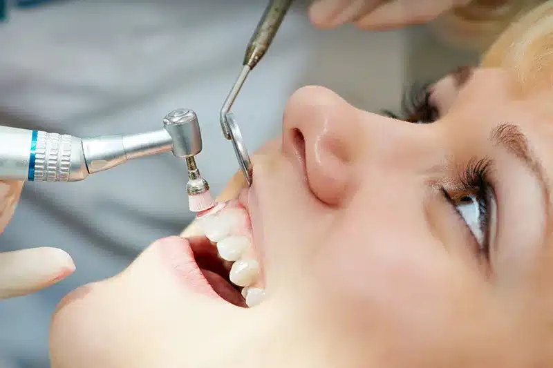 dental-cleaning